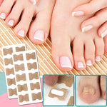 Nail Correction Patches (30 Pcs)